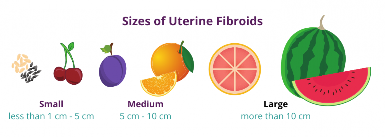 A Visual Guide To Fibroid Sizes Usa Fibroid Centers 