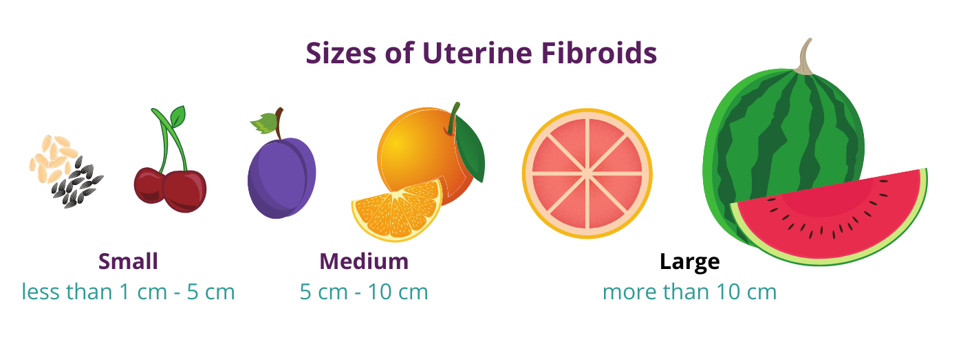 Fibroid Tumor Sizes a Visual Guide USA Fibroid Centers Mex Alex