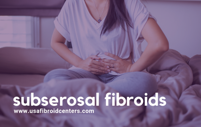 What Are Subserosal Fibroids? | USA Fibroid Centers