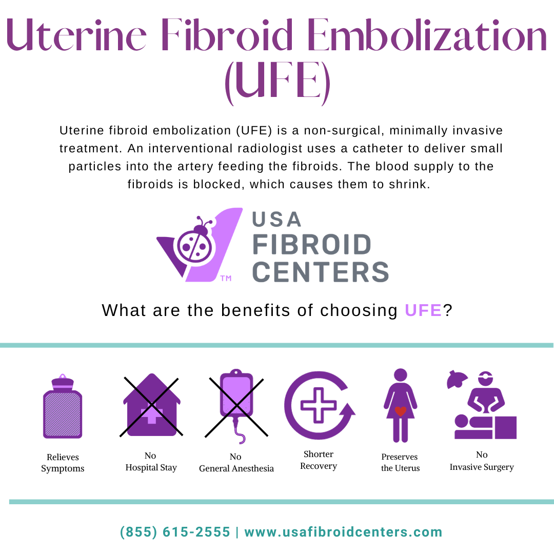 What Is Uterine Fibroid Embolization And How Does It Work